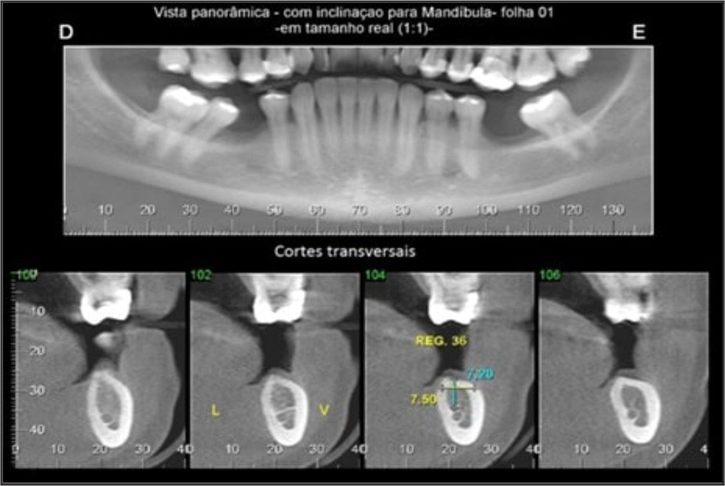 Página Cedimagem Diagnósticos - Tomografia do Maxilar e